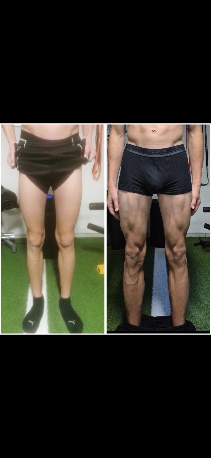 Before and After Transformation 12