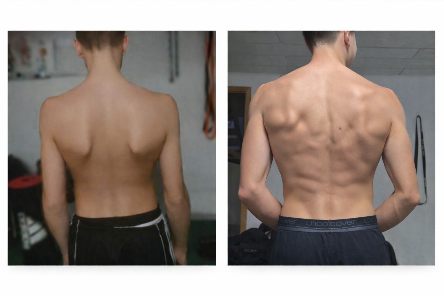 Before and After Transformation 13